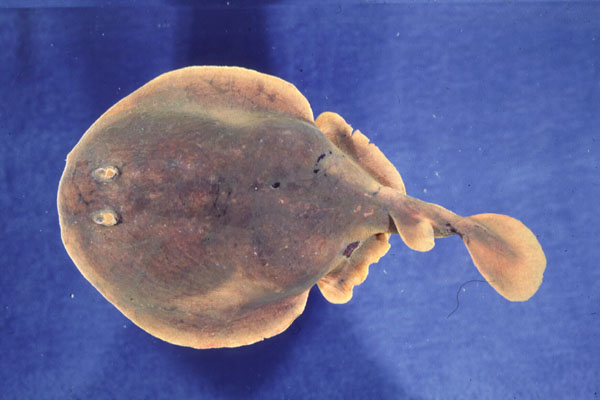 Onefin electric ray (Narke capensis) — Narkidae — 2